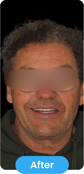 After Image